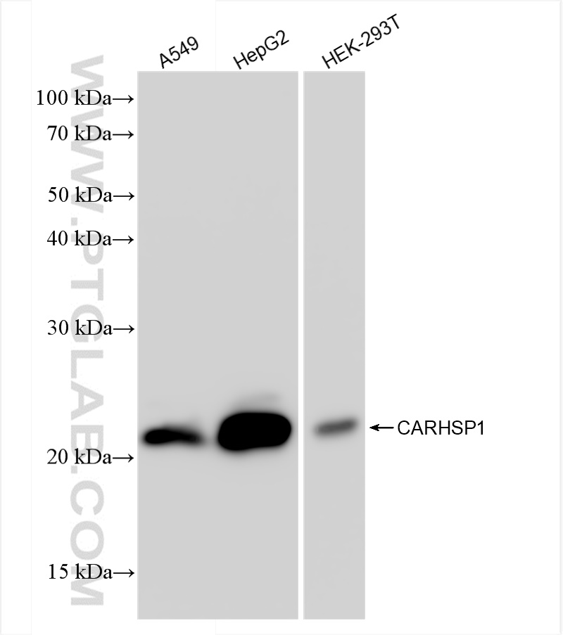 Western Blot (WB) analysis of various lysates using CARHSP1 Recombinant antibody (83300-3-RR)