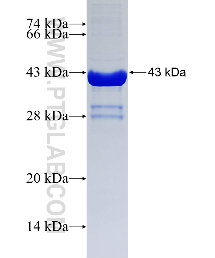 CARHSP1 fusion protein Ag2265 SDS-PAGE