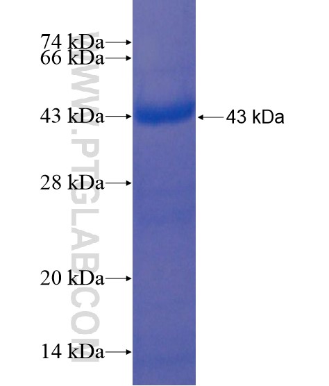 CARKD fusion protein Ag21959 SDS-PAGE