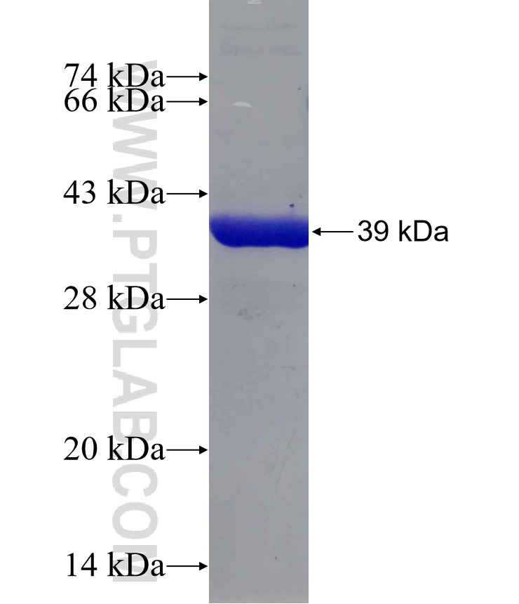 CARM1 fusion protein Ag30046 SDS-PAGE