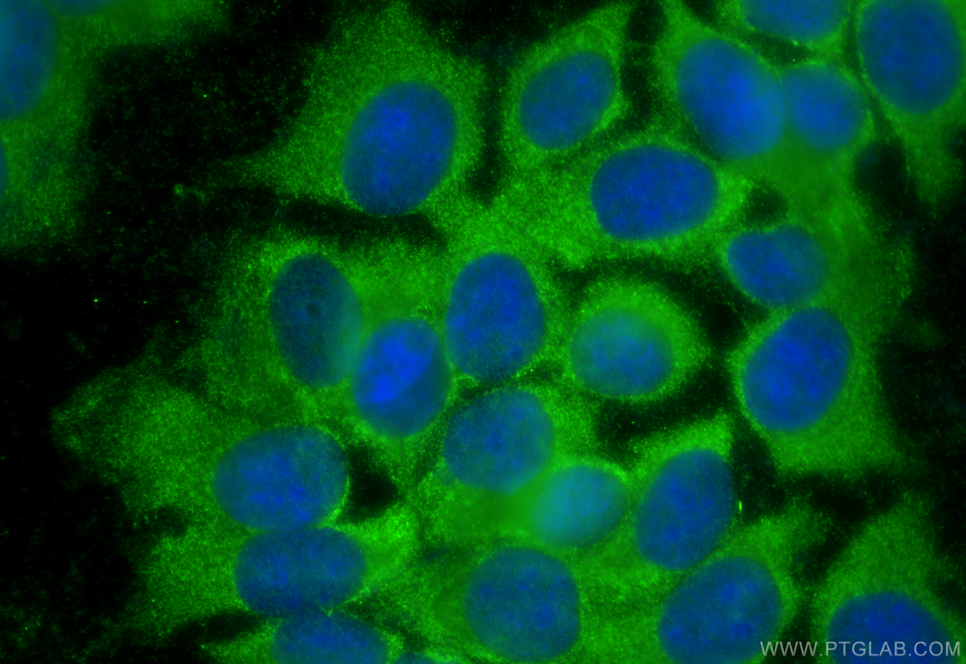 Immunofluorescence (IF) / fluorescent staining of MCF-7 cells using CARS Polyclonal antibody (15296-1-AP)