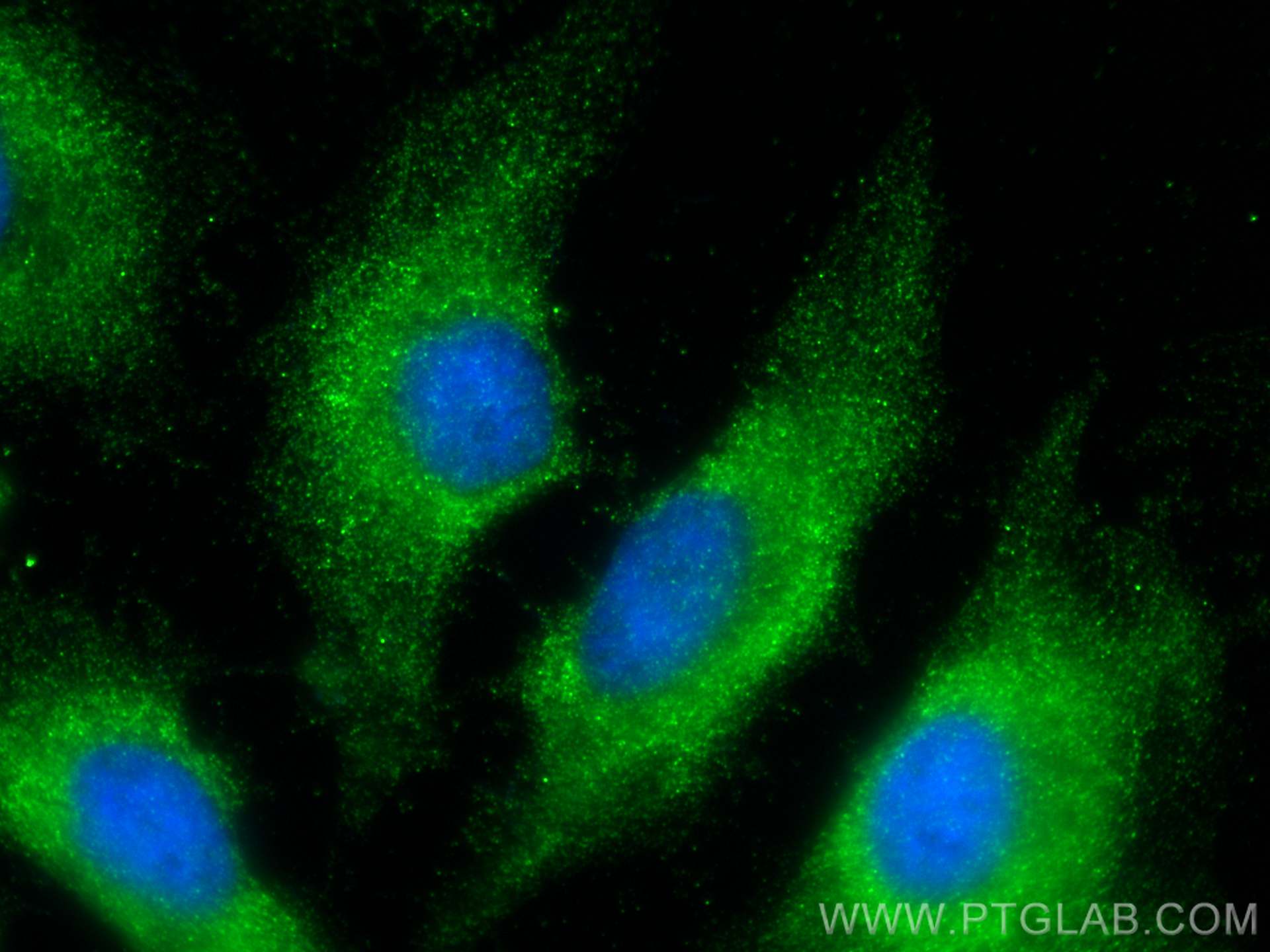 Immunofluorescence (IF) / fluorescent staining of HeLa cells using Caspase 8/p43/p18 Monoclonal antibody (66093-1-Ig)