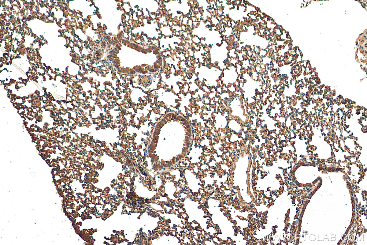 Immunohistochemistry (IHC) staining of mouse lung tissue using Caspase 9/p35/p10 Polyclonal antibody (10380-1-AP)