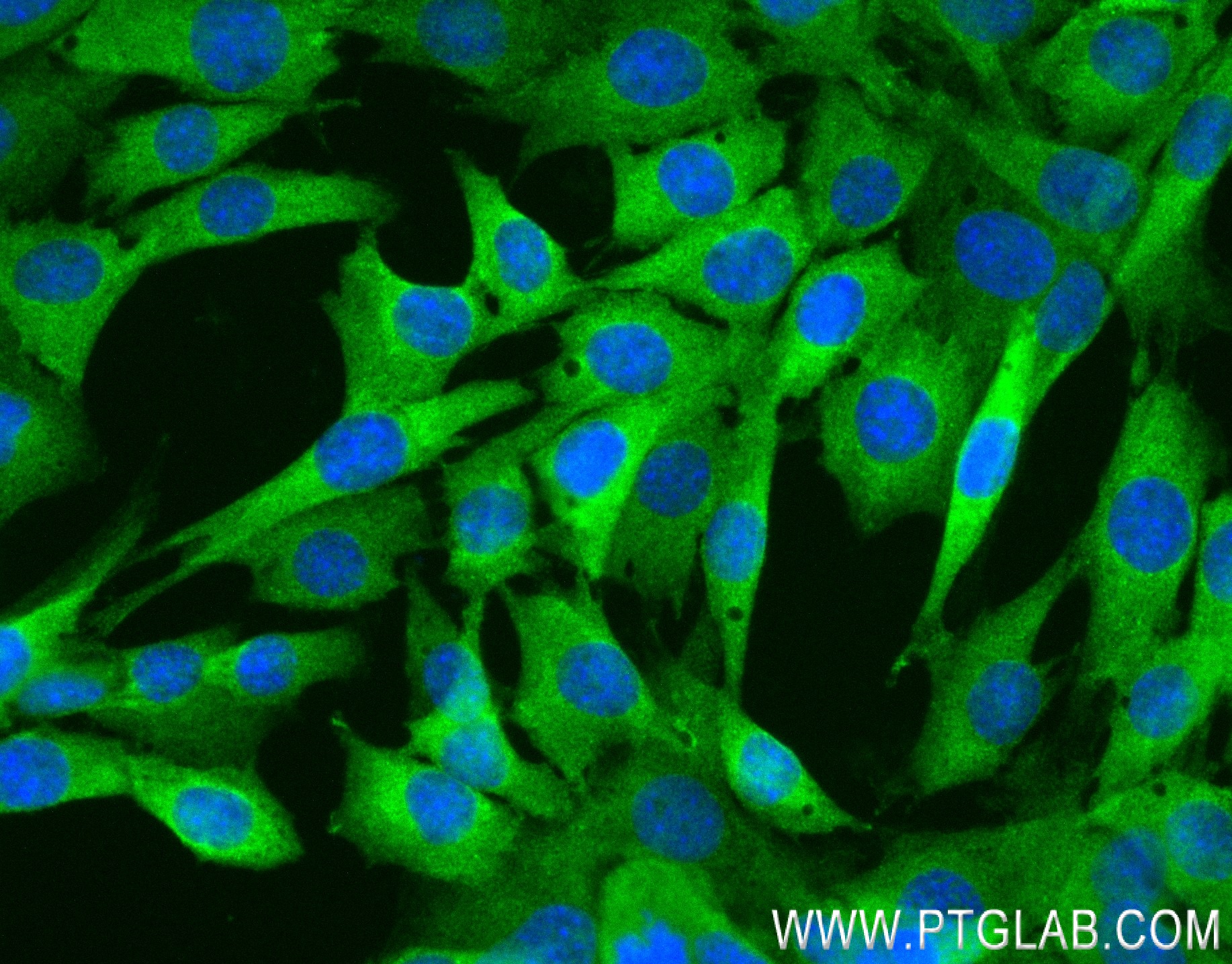 Immunofluorescence (IF) / fluorescent staining of C2C12 cells using CASQ2 Recombinant antibody (84056-6-RR)