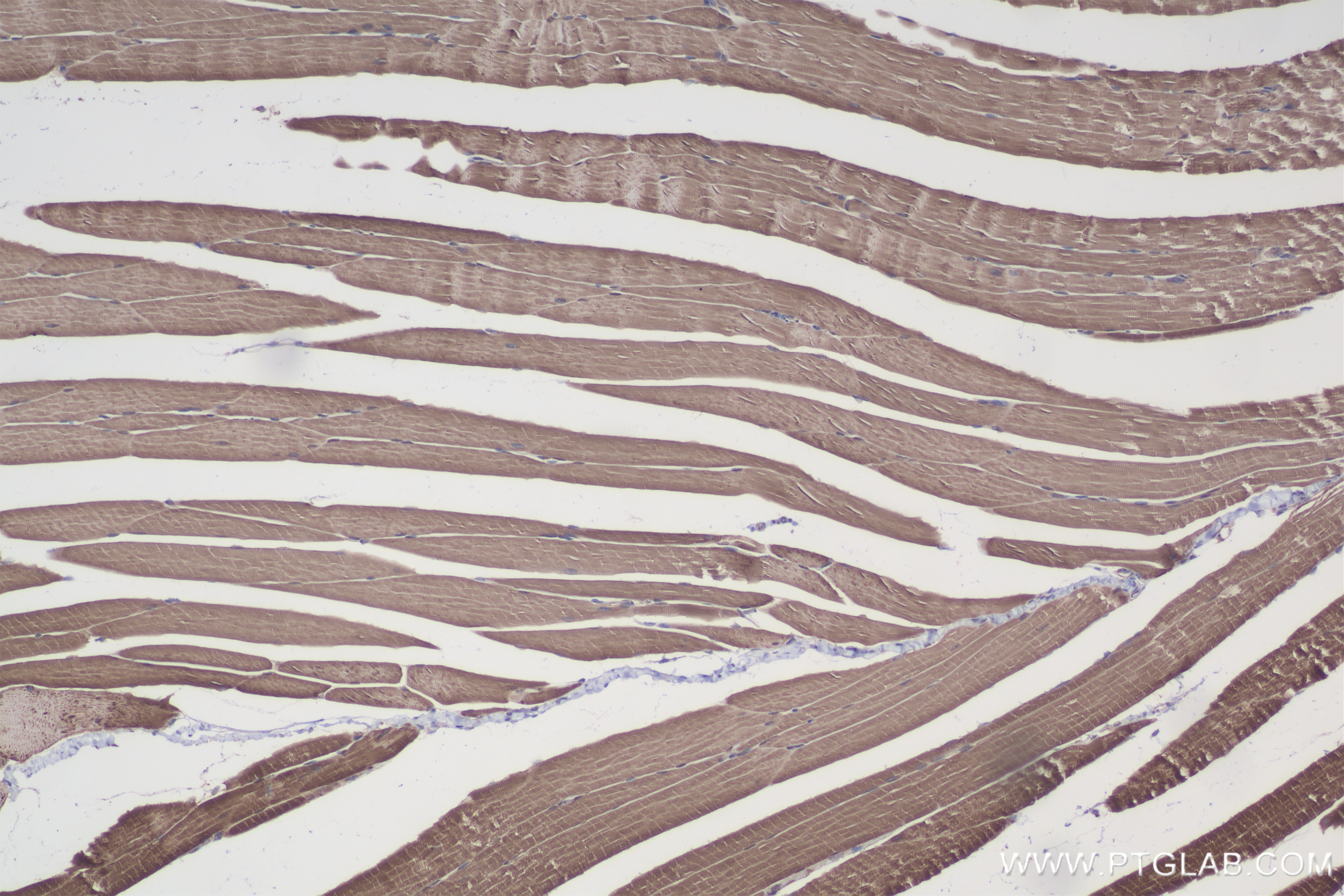 Immunohistochemistry (IHC) staining of mouse skeletal muscle tissue using Calsequestrin 2 Recombinant antibody (84056-6-RR)