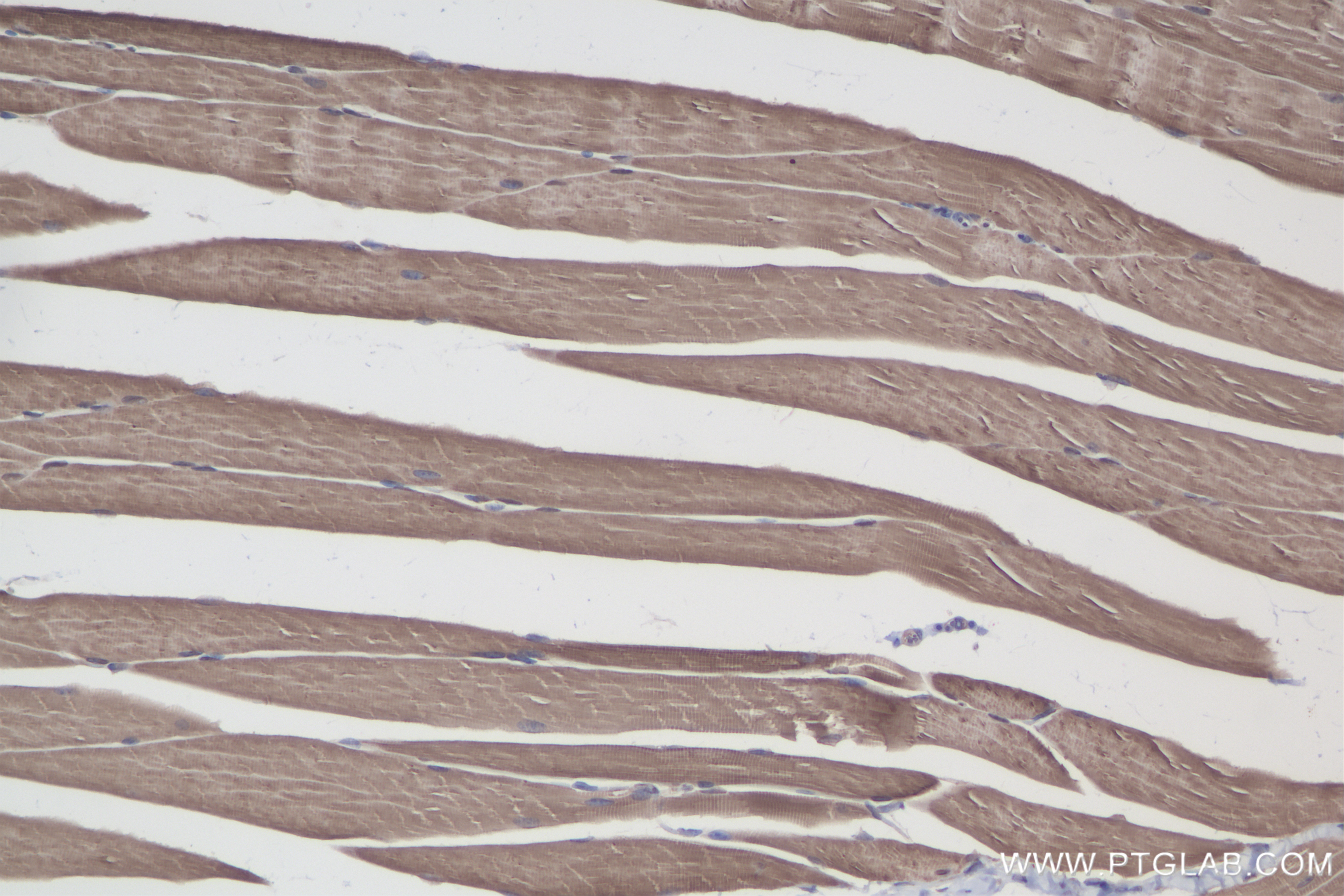 Immunohistochemistry (IHC) staining of mouse skeletal muscle tissue using Calsequestrin 2 Recombinant antibody (84056-6-RR)