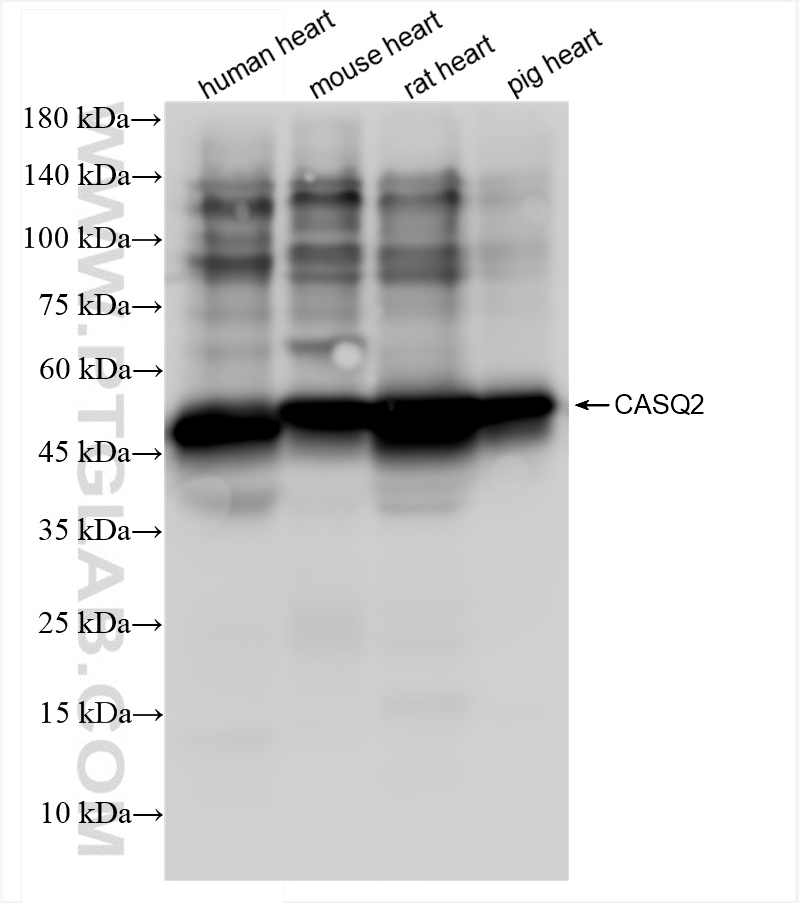 Western Blot (WB) analysis of various lysates using CASQ2 Recombinant antibody (84056-6-RR)