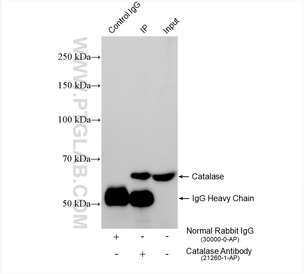 Immunoprecipitation (IP) experiment of HeLa cells using Catalase Polyclonal antibody (21260-1-AP)