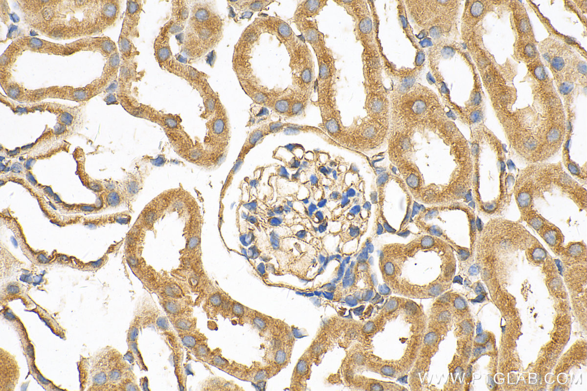 Immunohistochemistry (IHC) staining of mouse kidney tissue using Caveolin-1 Polyclonal antibody (16447-1-AP)