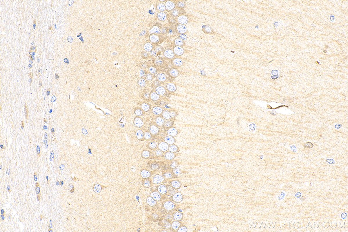 Immunohistochemistry (IHC) staining of mouse brain tissue using Caveolin-1 Polyclonal antibody (16447-1-AP)