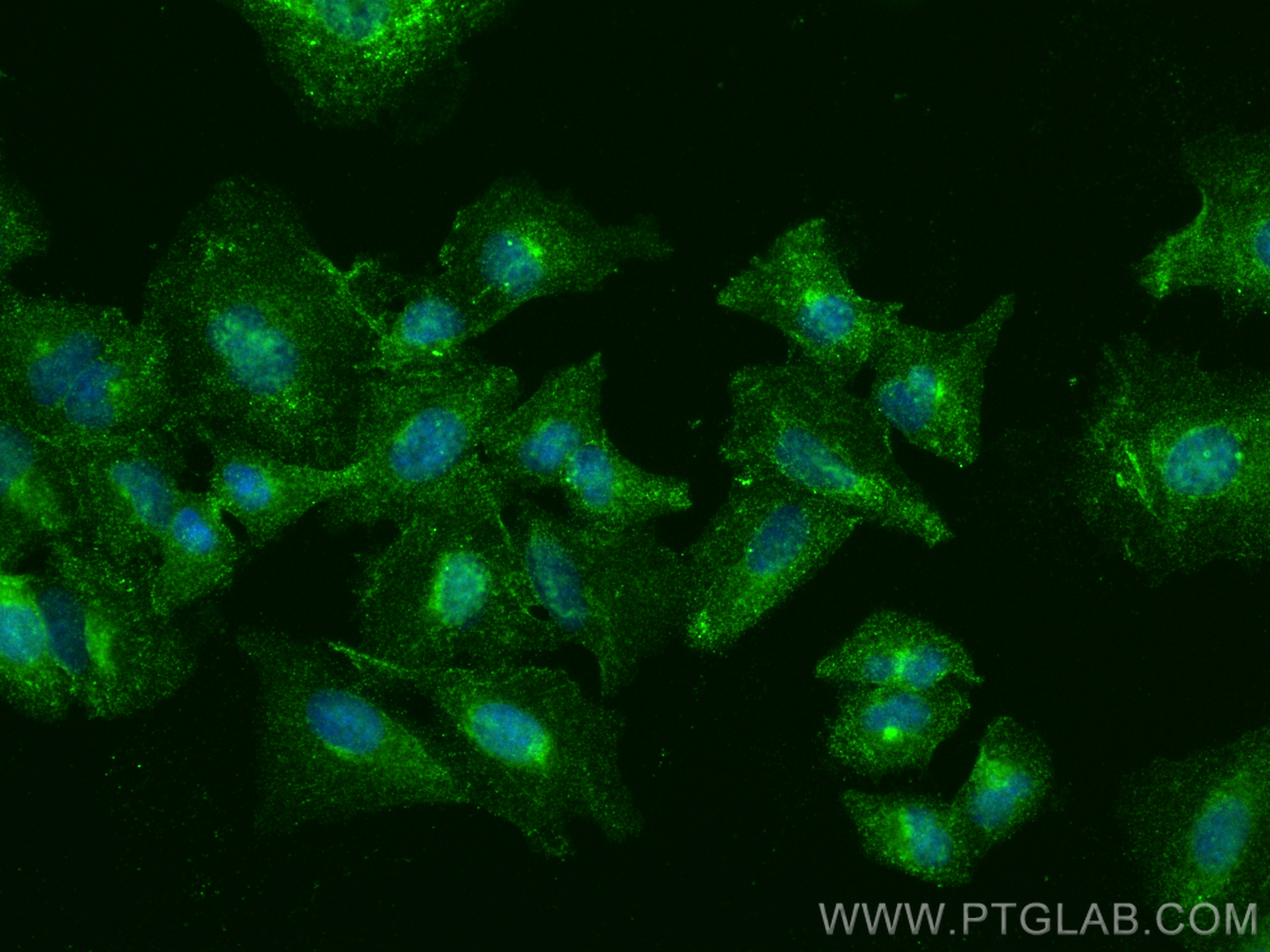 Immunofluorescence (IF) / fluorescent staining of A549 cells using Caveolin-1 Monoclonal antibody (66067-1-Ig)