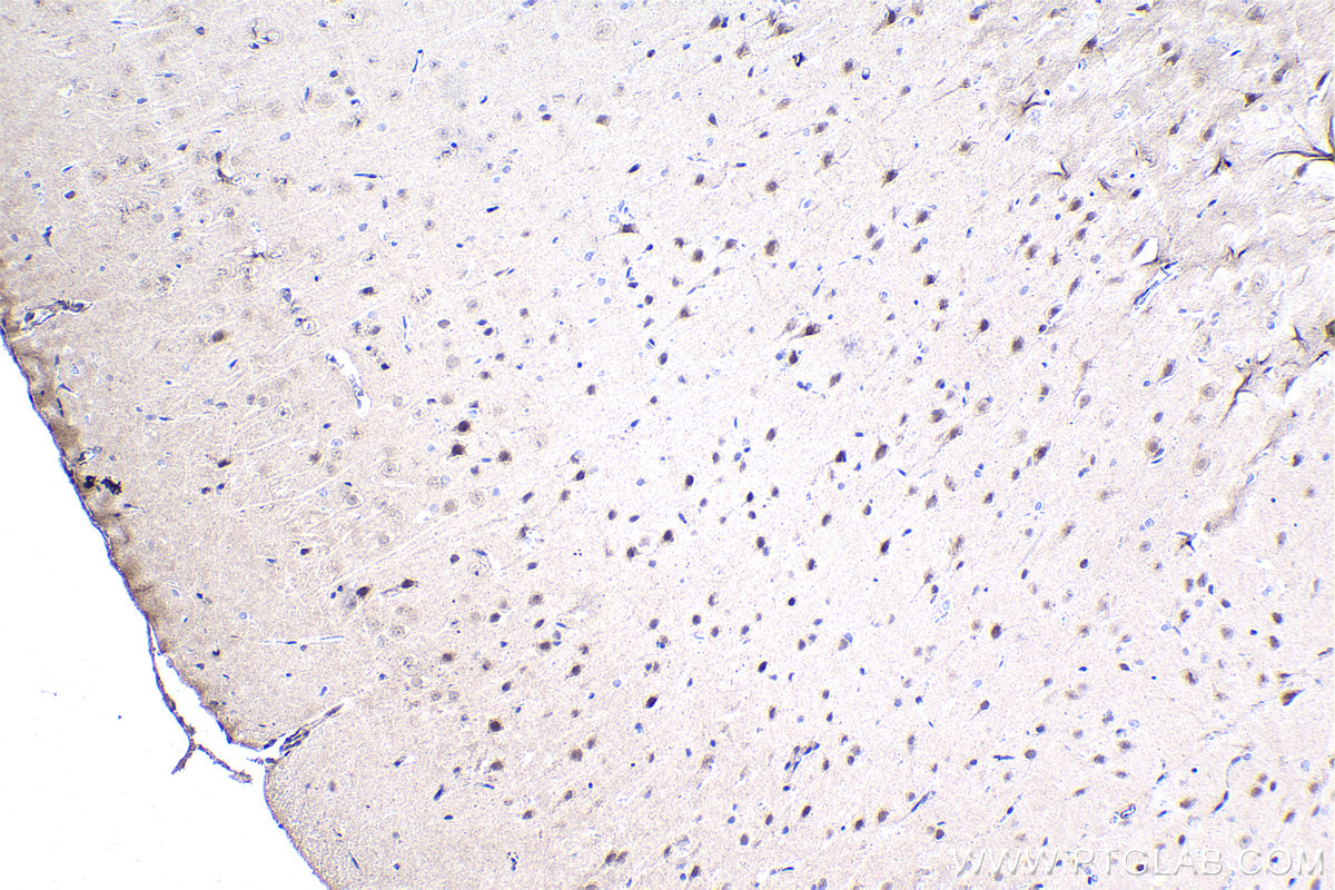 Immunohistochemistry (IHC) staining of rat brain tissue using CBFA2T3 Polyclonal antibody (17190-1-AP)