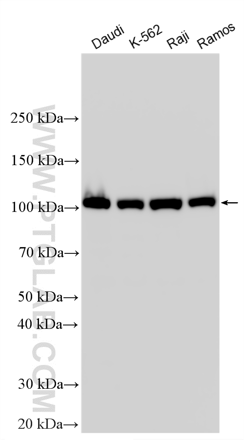 Western Blot (WB) analysis of various lysates using c-Cbl Polyclonal antibody (25818-1-AP)