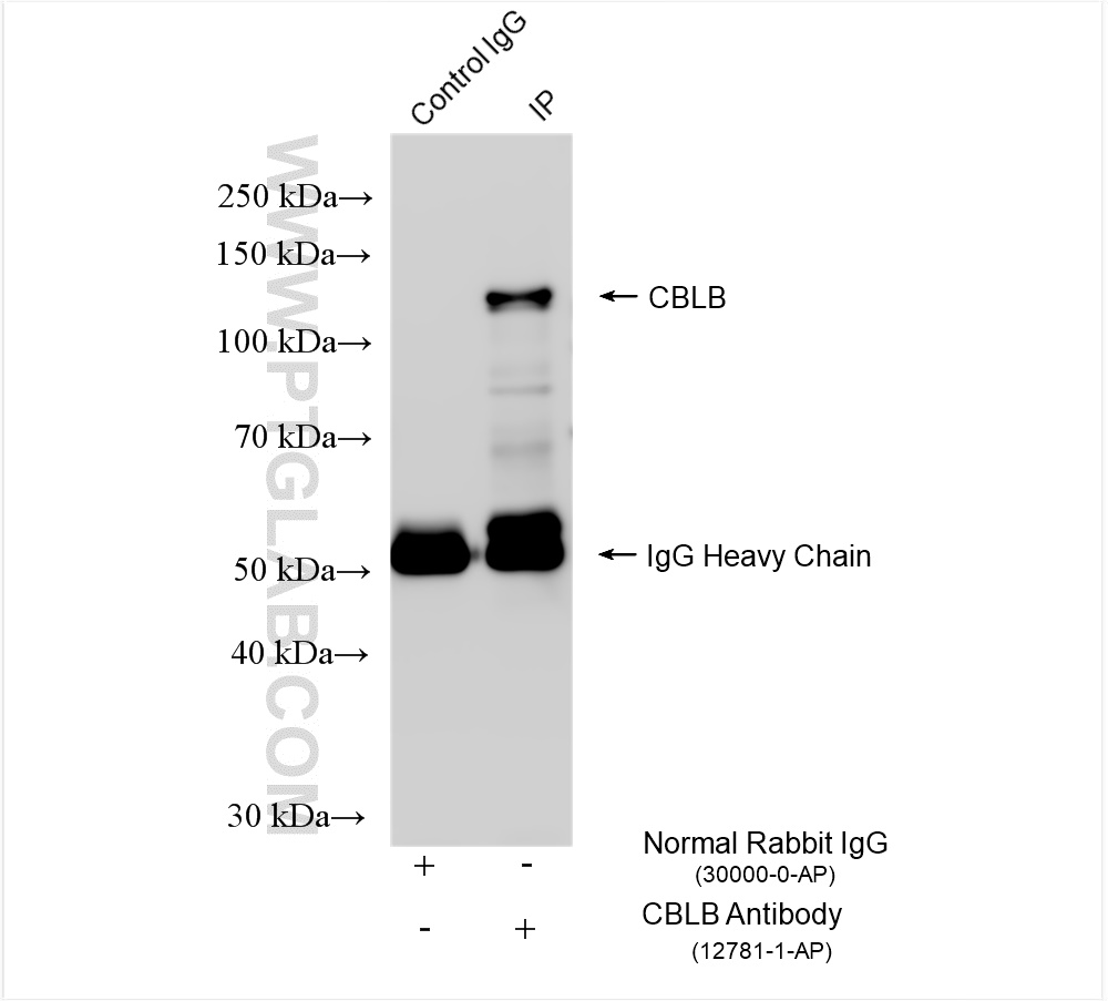 Immunoprecipitation (IP) experiment of HEK-293 cells using CBLB Polyclonal antibody (12781-1-AP)