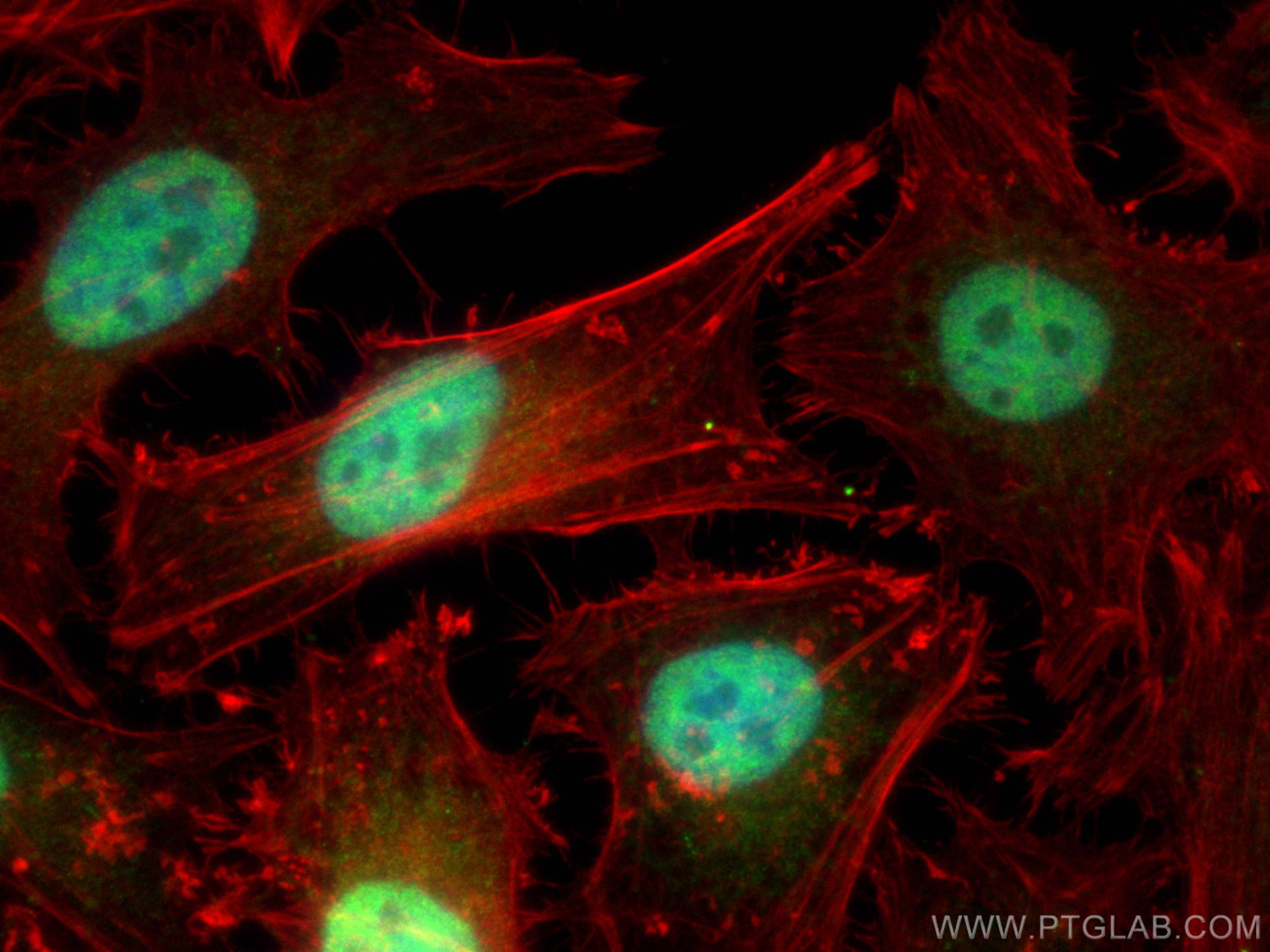 Immunofluorescence (IF) / fluorescent staining of HeLa cells using CBP20 Polyclonal antibody (11950-1-AP)