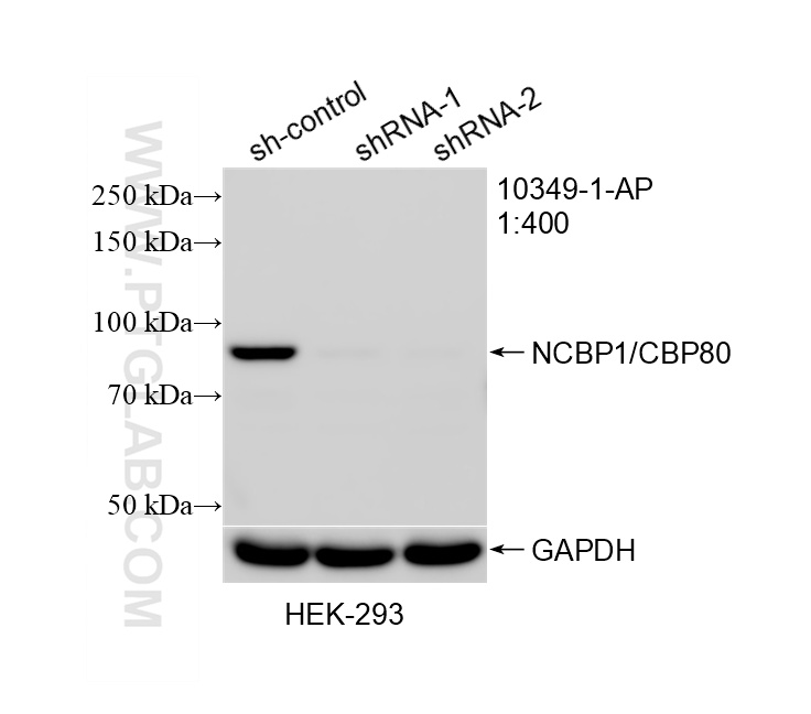 Western Blot (WB) analysis of HEK-293 cells using NCBP1/CBP80 Polyclonal antibody (10349-1-AP)