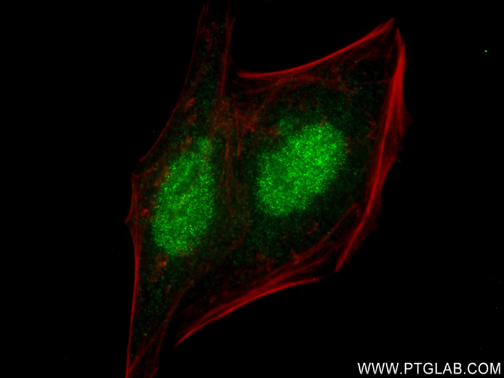 Immunofluorescence (IF) / fluorescent staining of HepG2 cells using CBP80 Recombinant antibody (83212-4-RR)