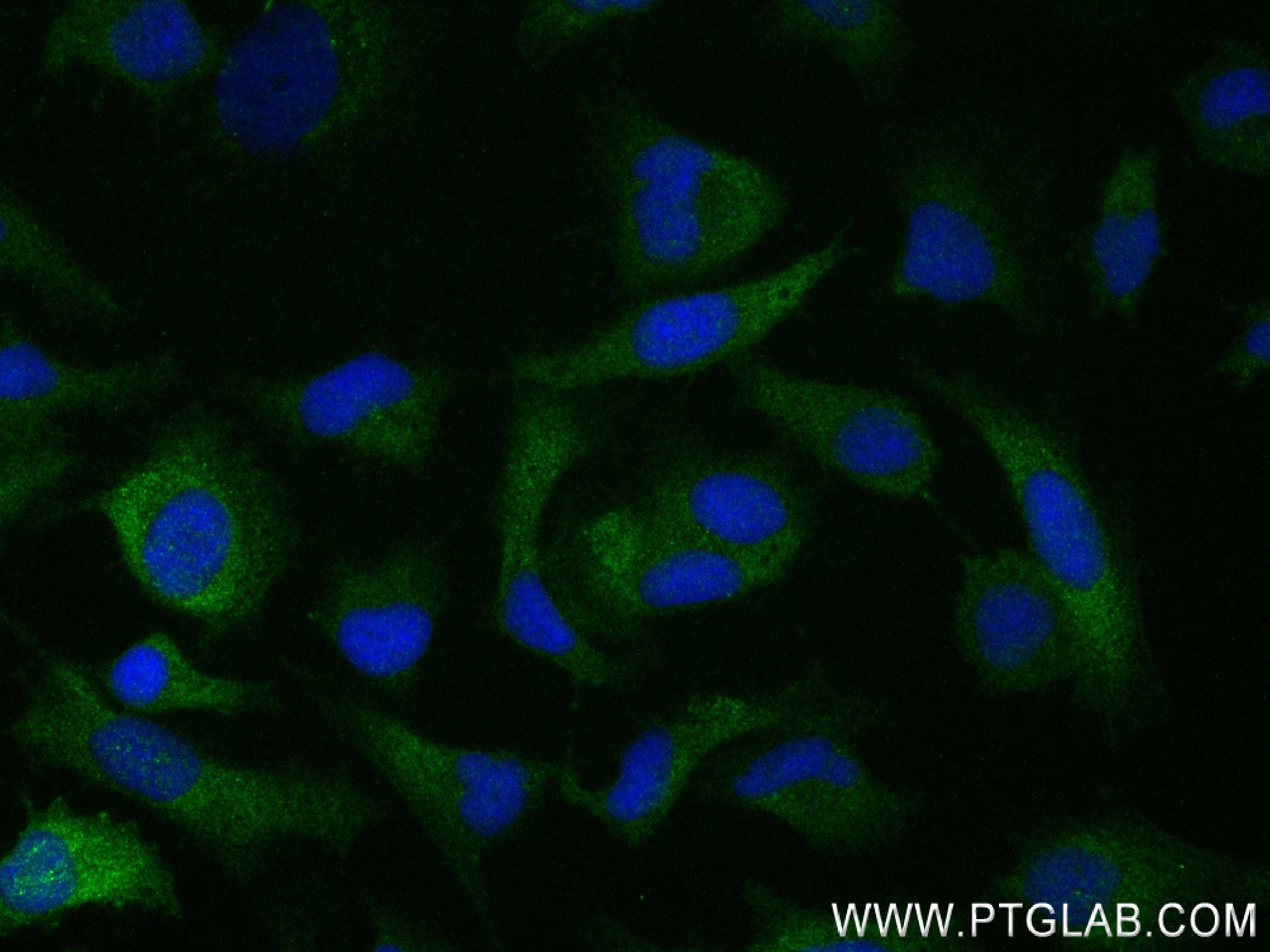 Immunofluorescence (IF) / fluorescent staining of HeLa cells using CBR1 Recombinant antibody (83736-4-RR)