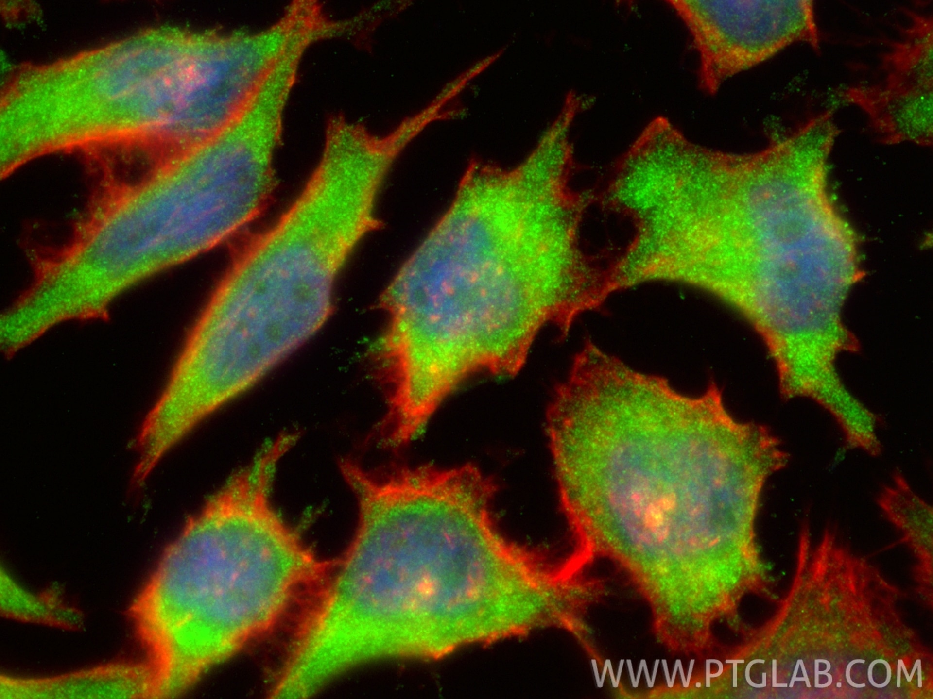 Immunofluorescence (IF) / fluorescent staining of HeLa cells using CBS Polyclonal antibody (14787-1-AP)