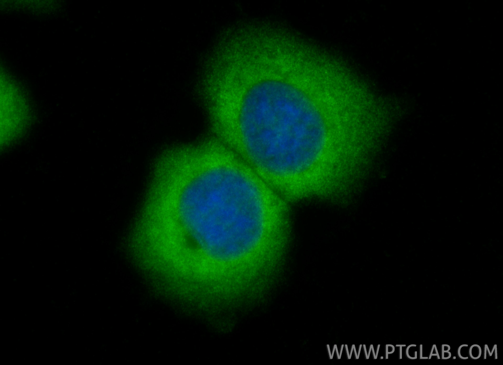 Immunofluorescence (IF) / fluorescent staining of MCF-7 cells using CBS Polyclonal antibody (14787-1-AP)