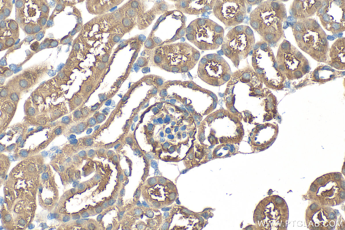Immunohistochemistry (IHC) staining of mouse kidney tissue using CBS Polyclonal antibody (14787-1-AP)
