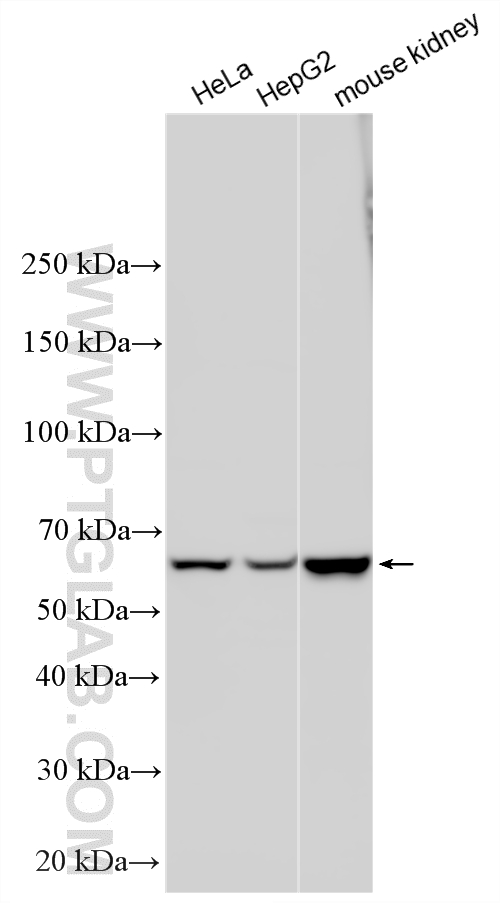 Western Blot (WB) analysis of various lysates using CBS Polyclonal antibody (14787-1-AP)