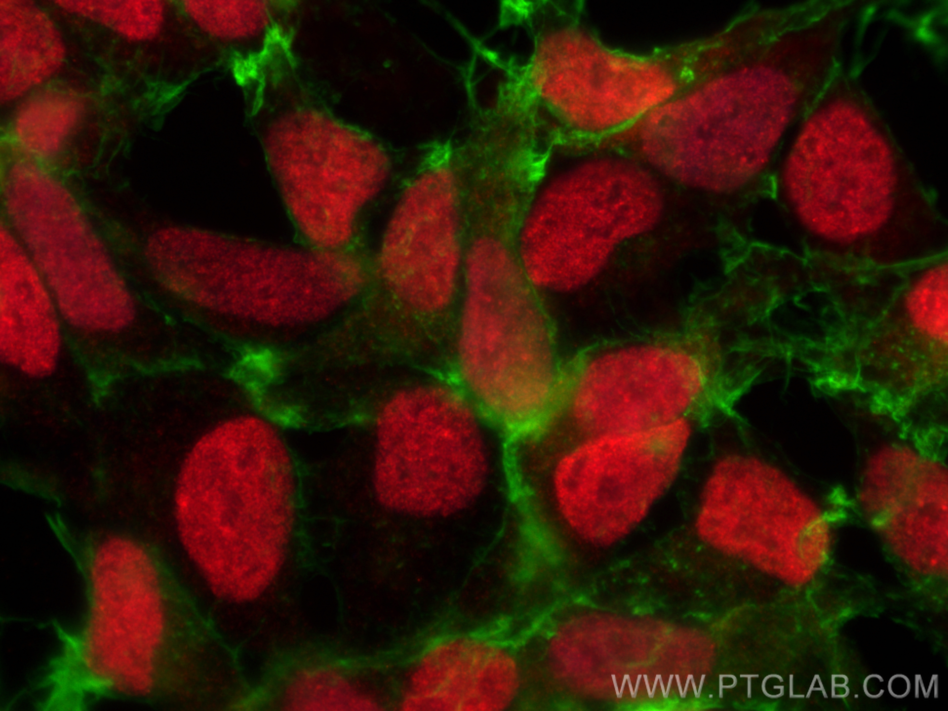 Immunofluorescence (IF) / fluorescent staining of HEK-293 cells using CBX1 Polyclonal antibody (10241-2-AP)