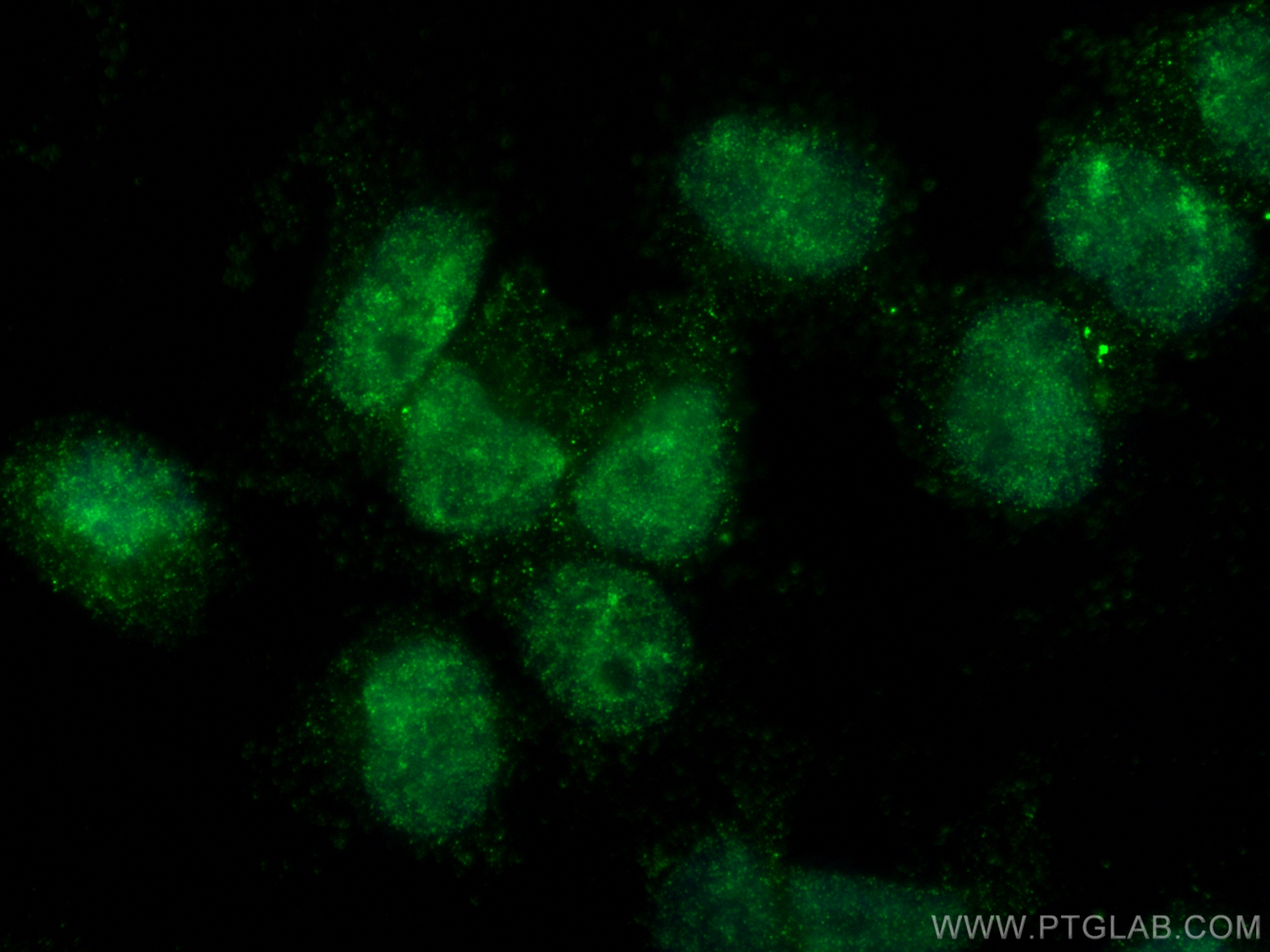 Immunofluorescence (IF) / fluorescent staining of HEK-293 cells using CBX2 Monoclonal antibody (68244-1-Ig)