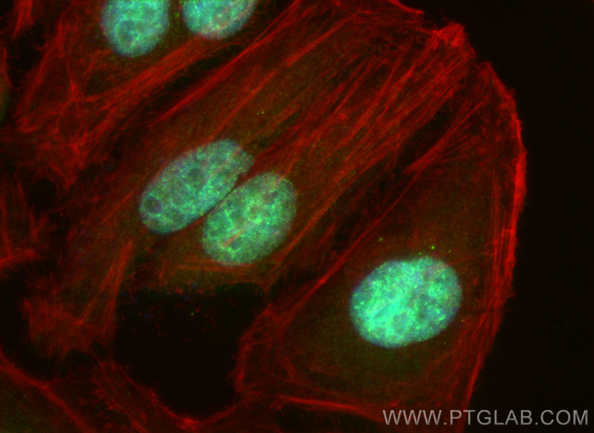 Immunofluorescence (IF) / fluorescent staining of HeLa cells using CBX4 Polyclonal antibody (18544-1-AP)