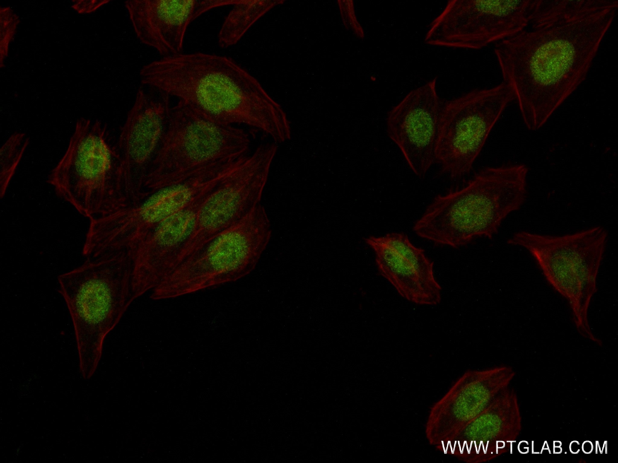 Immunofluorescence (IF) / fluorescent staining of HepG2 cells using CBX5 Recombinant antibody (83258-5-RR)