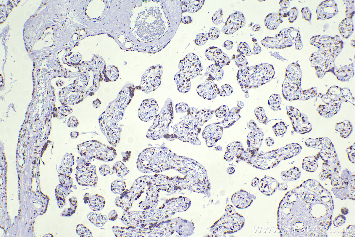 Immunohistochemistry (IHC) staining of human placenta tissue using CBX5 Recombinant antibody (83258-5-RR)