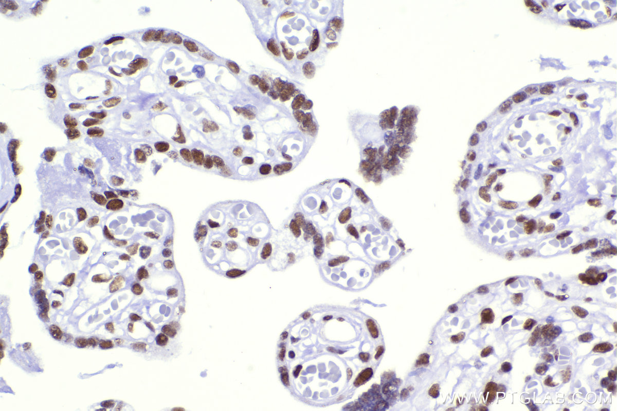 Immunohistochemistry (IHC) staining of human placenta tissue using CBX5 Recombinant antibody (83258-5-RR)