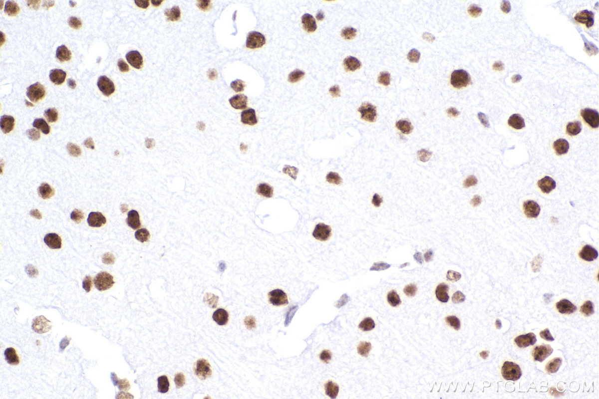 Immunohistochemistry (IHC) staining of mouse brain tissue using CBX5 Recombinant antibody (83258-5-RR)