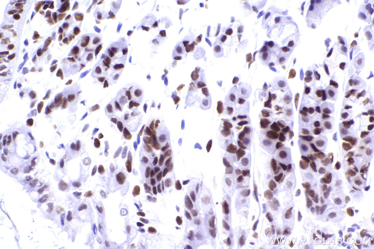 Immunohistochemistry (IHC) staining of mouse stomach tissue using CBX5 Recombinant antibody (83258-5-RR)