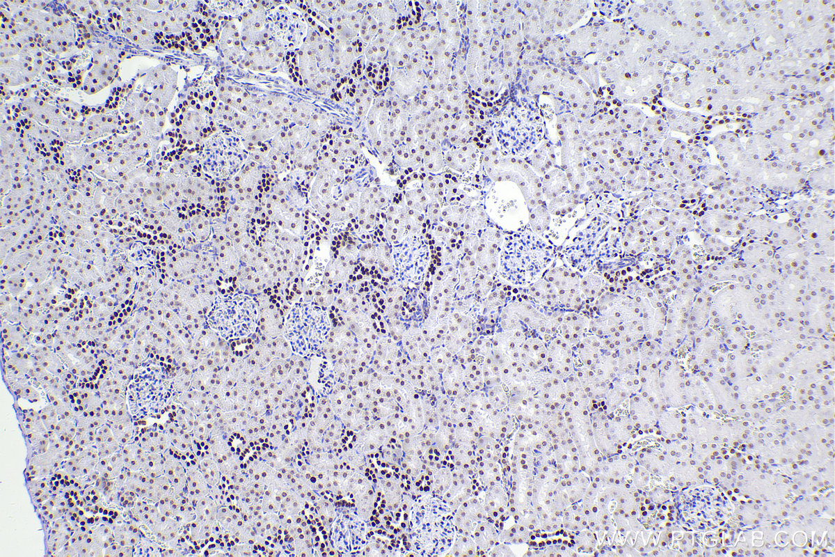 Immunohistochemistry (IHC) staining of rat kidney tissue using CBX5 Recombinant antibody (83258-5-RR)