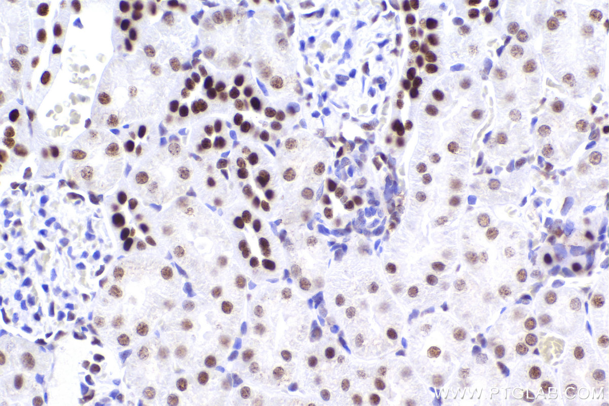 Immunohistochemistry (IHC) staining of rat kidney tissue using CBX5 Recombinant antibody (83258-5-RR)