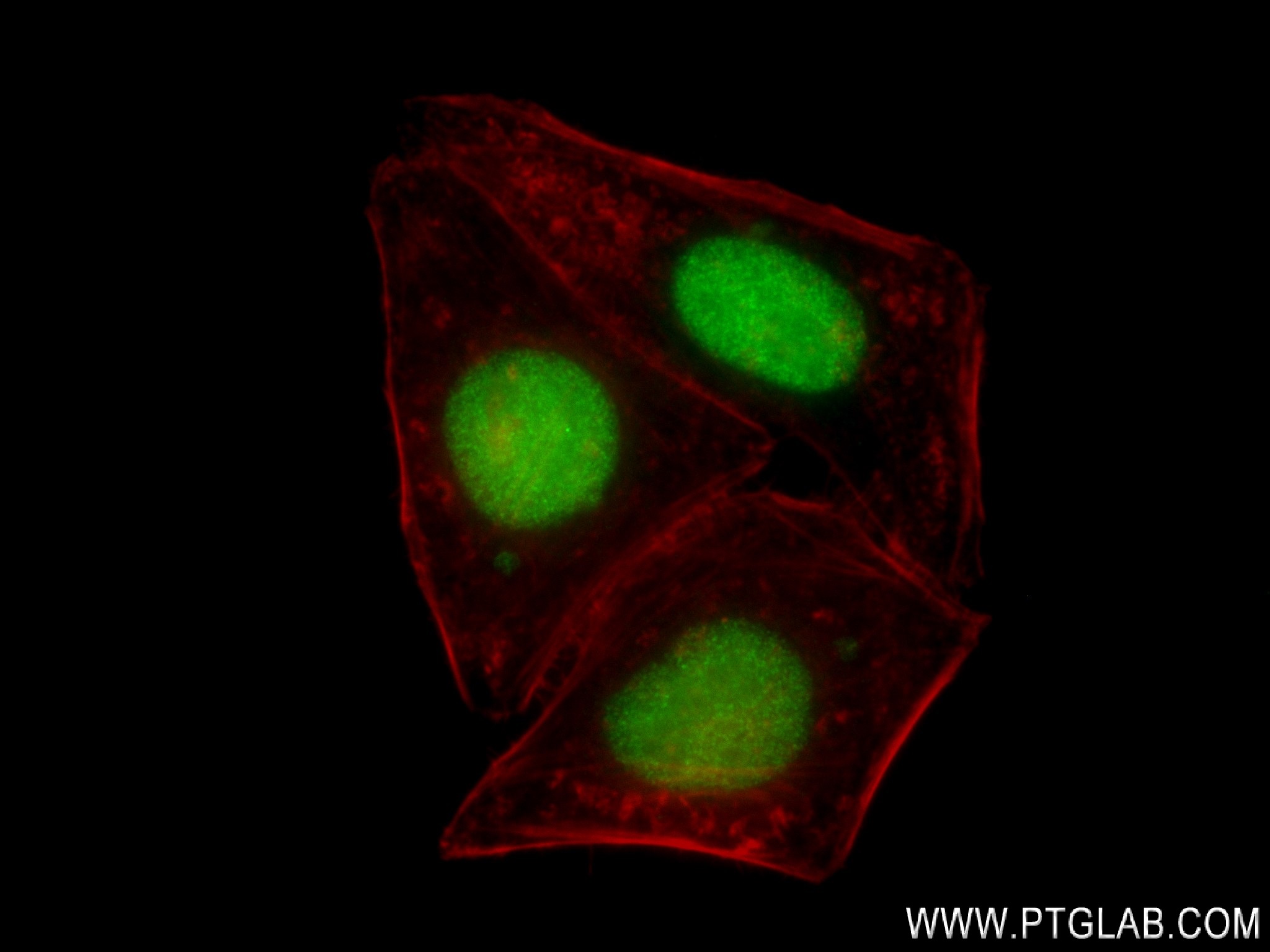 Immunofluorescence (IF) / fluorescent staining of HepG2 cells using CBX5 Recombinant antibody (83258-6-RR)