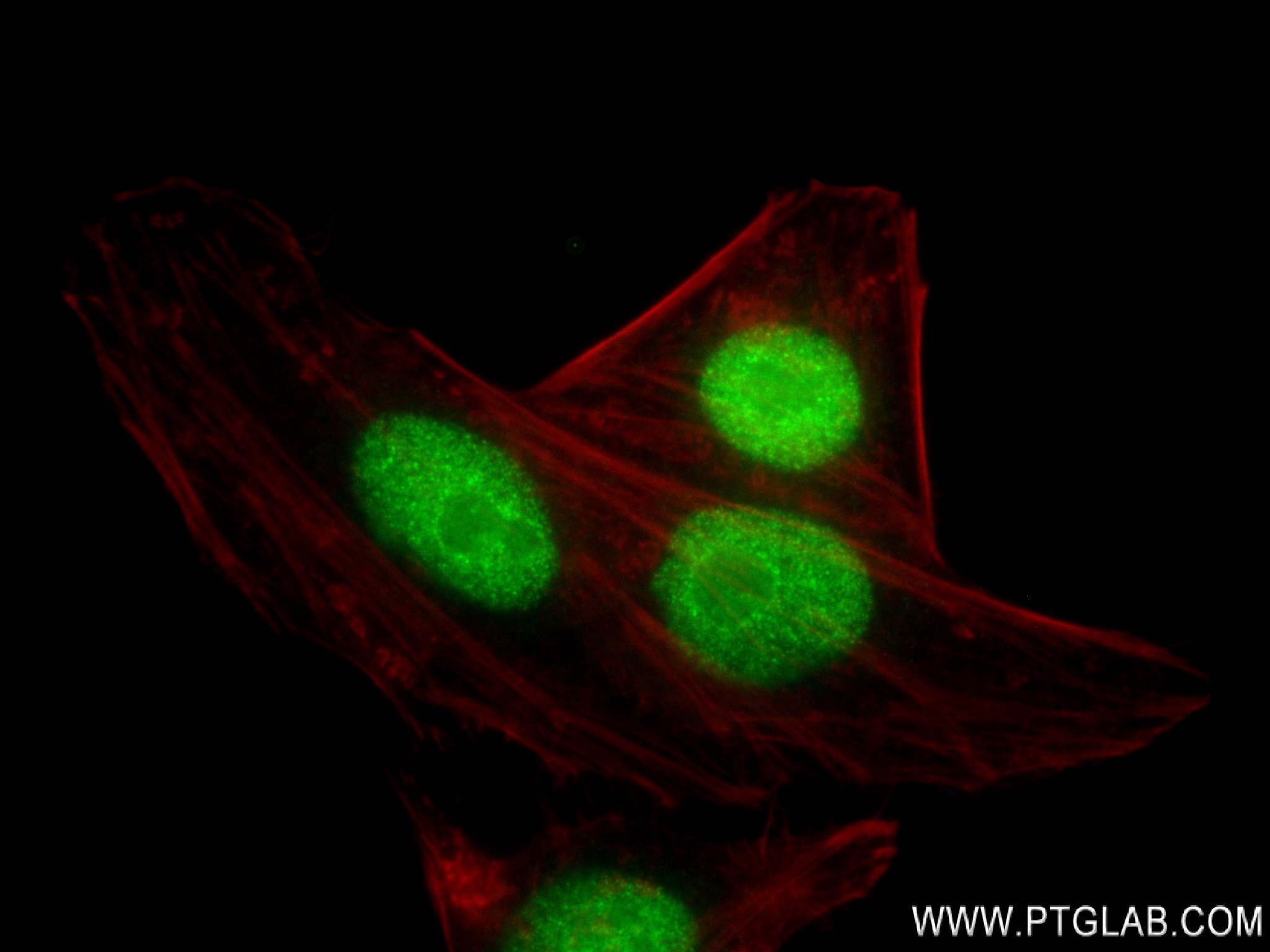 Immunofluorescence (IF) / fluorescent staining of HepG2 cells using CBX5 Recombinant antibody (83258-6-RR)