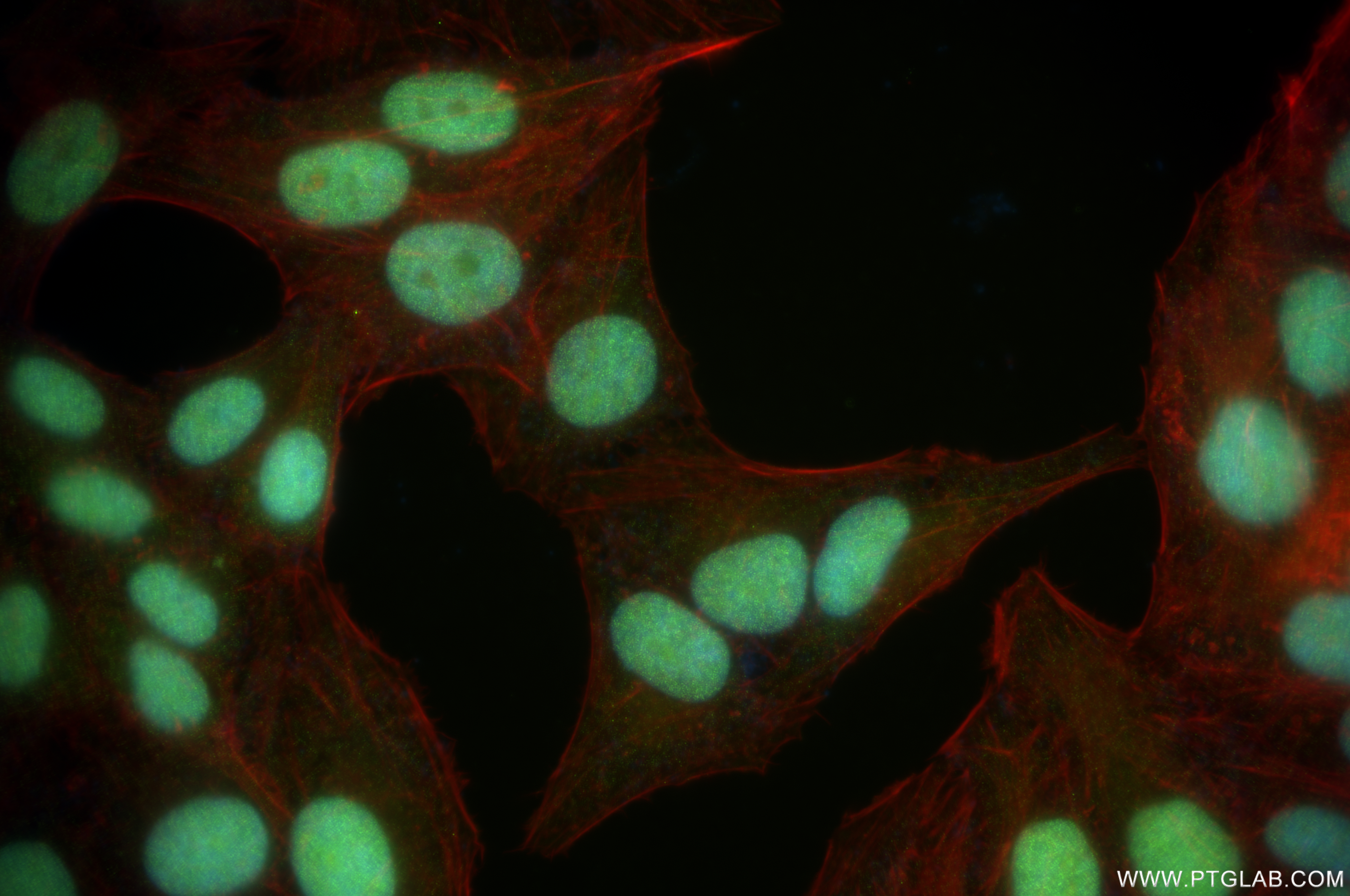 Immunofluorescence (IF) / fluorescent staining of HepG2 cells using CBX5 Recombinant antibody (83258-6-RR)