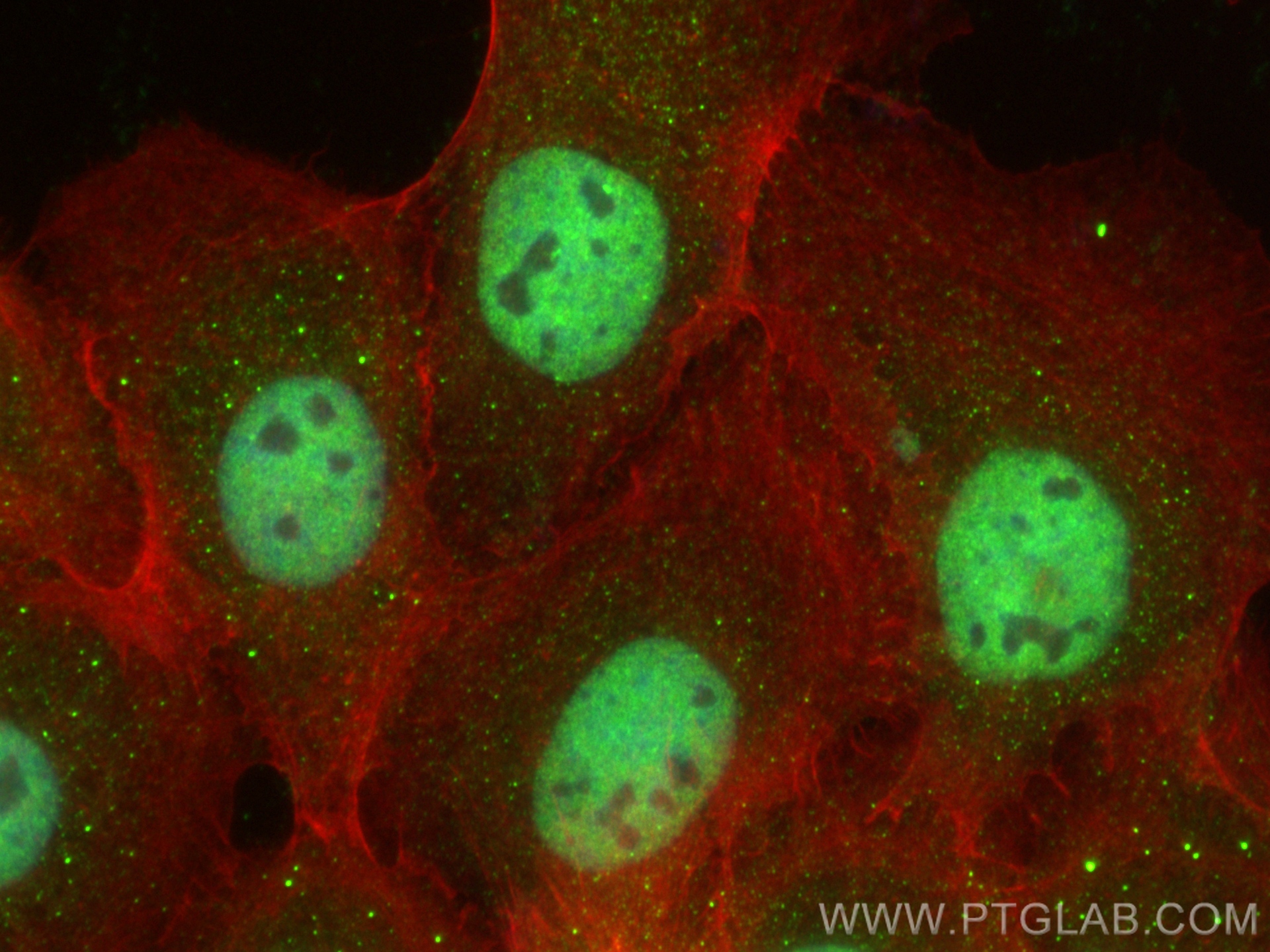 Immunofluorescence (IF) / fluorescent staining of A431 cells using CCAR1 Polyclonal antibody (25232-1-AP)