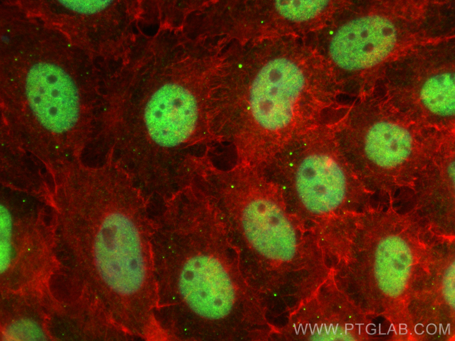 Immunofluorescence (IF) / fluorescent staining of A431 cells using CCAR1 Polyclonal antibody (25232-1-AP)