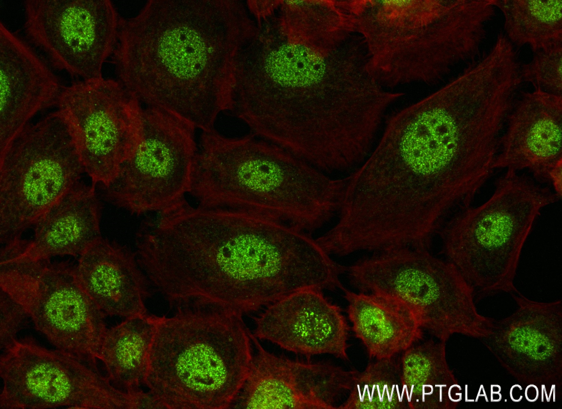 Immunofluorescence (IF) / fluorescent staining of A431 cells using CCAR1 Recombinant antibody (83936-4-RR)