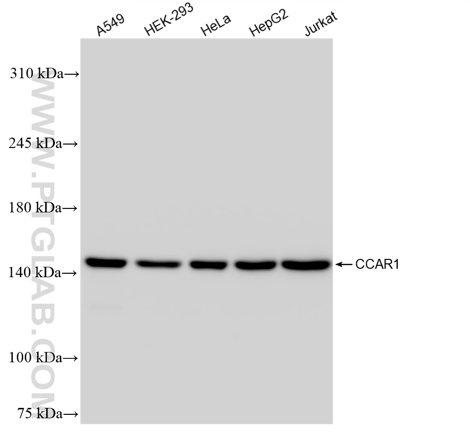 Western Blot (WB) analysis of various lysates using CCAR1 Recombinant antibody (83936-4-RR)