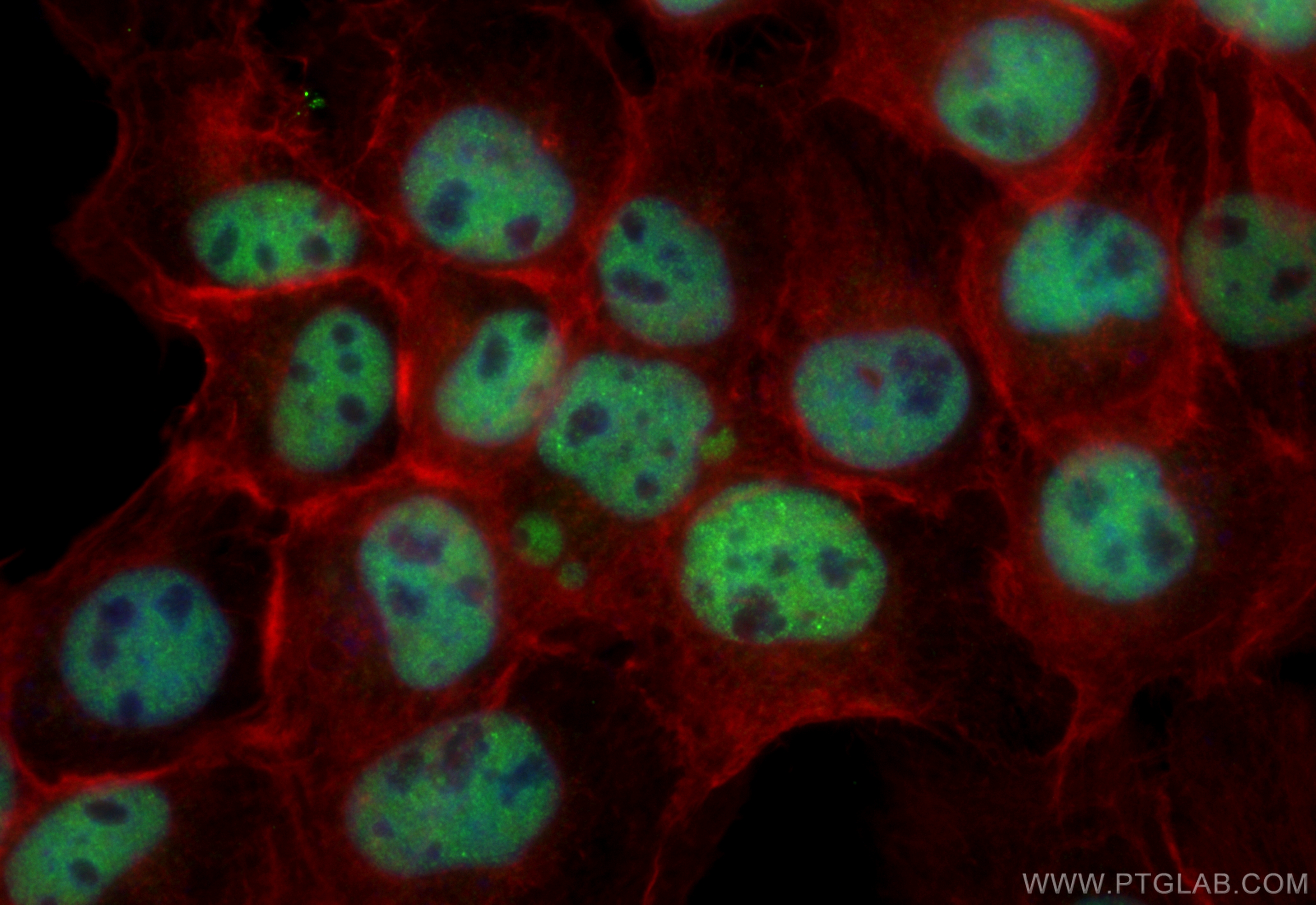 Immunofluorescence (IF) / fluorescent staining of A431 cells using CoraLite® Plus 488-conjugated CCAR1 Recombinant an (CL488-83936-4)