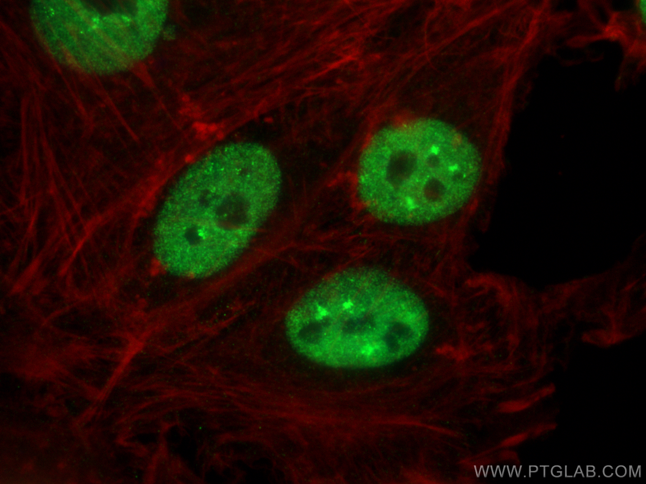 Immunofluorescence (IF) / fluorescent staining of HeLa cells using CCAR2 Monoclonal antibody (66497-1-Ig)