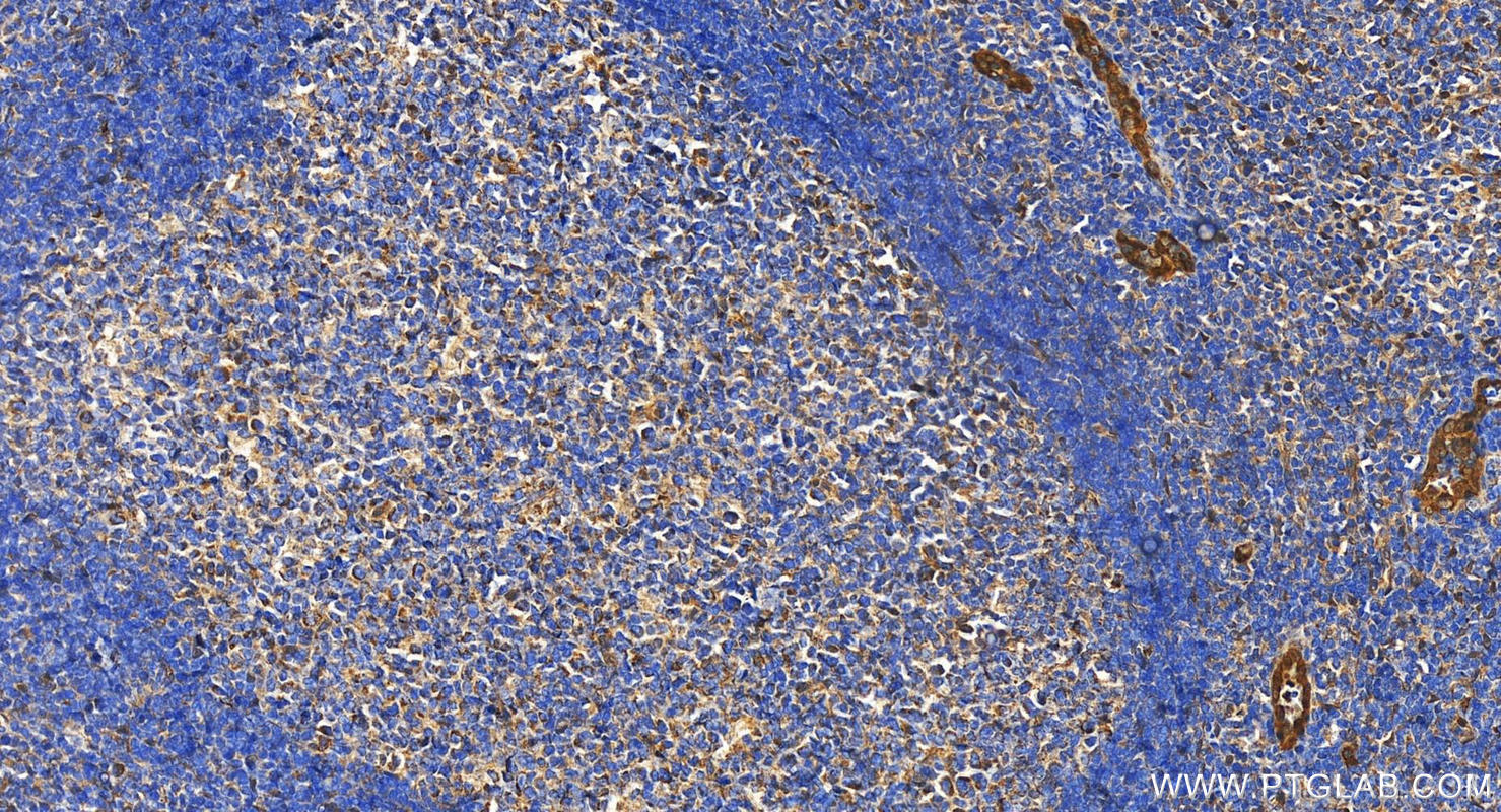 Immunohistochemistry (IHC) staining of human tonsillitis tissue using ACKR2 Polyclonal antibody (11386-1-AP)