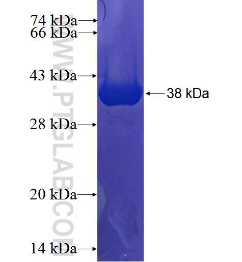 CCDC102A fusion protein Ag22745 SDS-PAGE