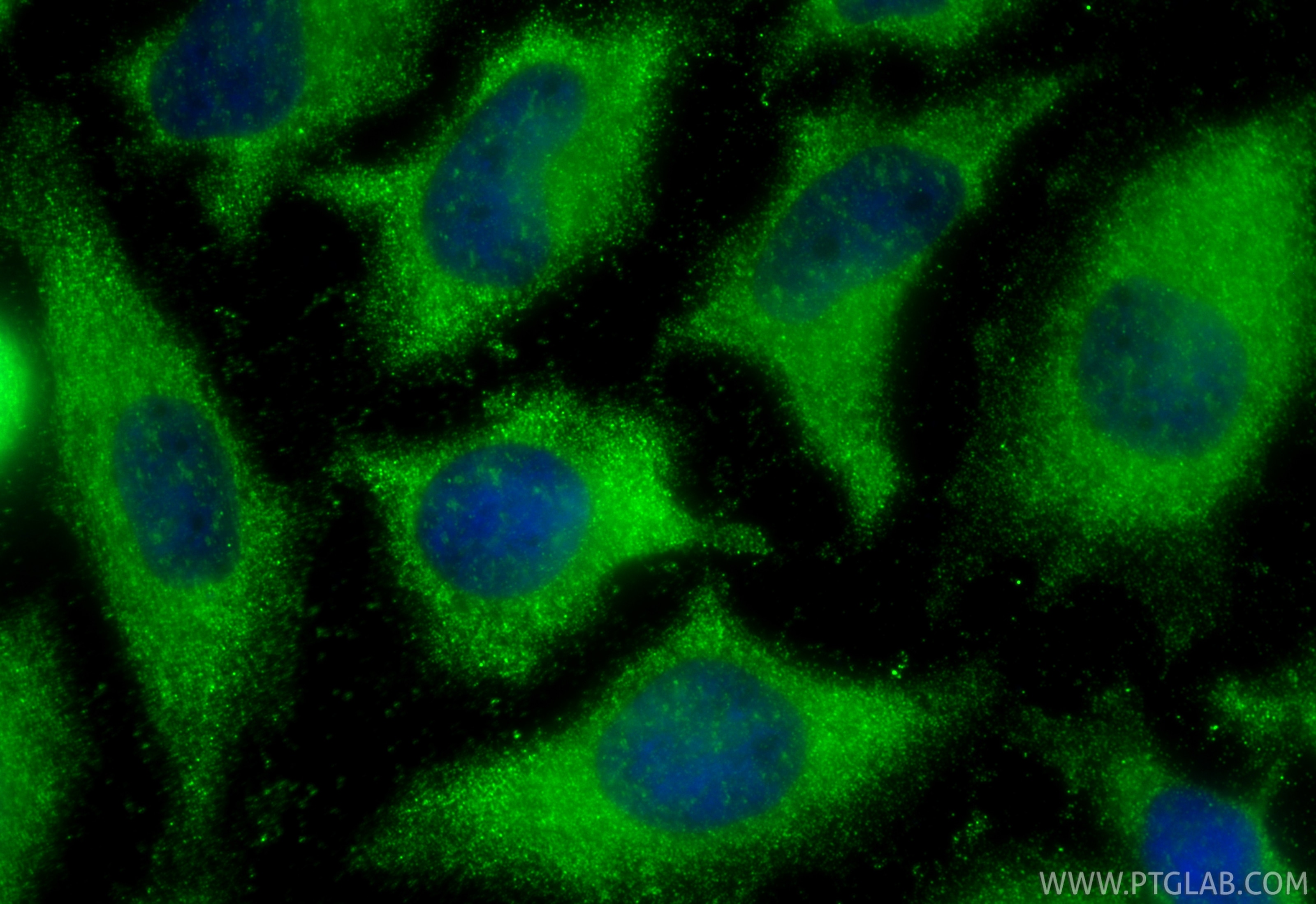 Immunofluorescence (IF) / fluorescent staining of HeLa cells using CCDC111/PRIMPOL Polyclonal antibody (29824-1-AP)