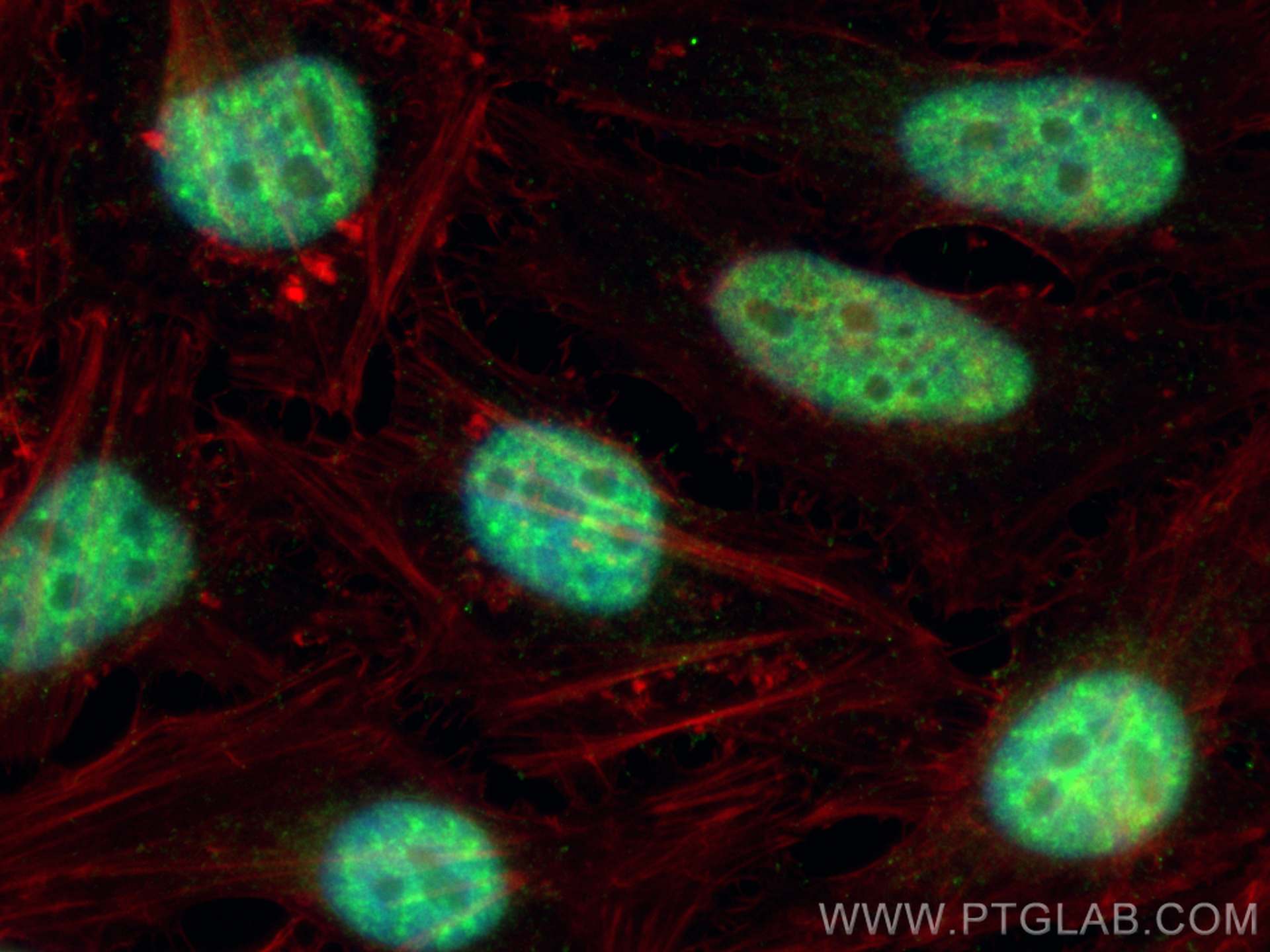 Immunofluorescence (IF) / fluorescent staining of HeLa cells using CCDC12 Polyclonal antibody (25138-1-AP)