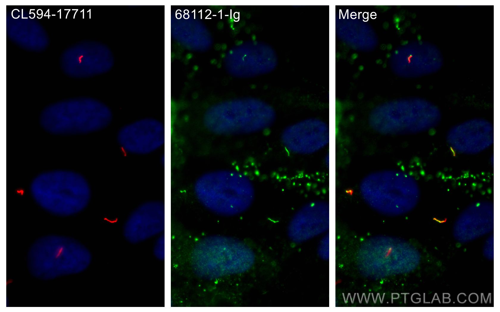 Immunofluorescence (IF) / fluorescent staining of hTERT-RPE1 cells using CEP89, CCDC123 Monoclonal antibody (68112-1-Ig)